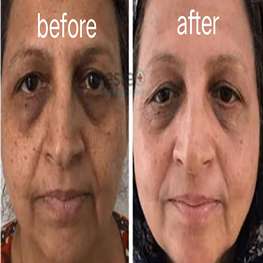 herbal-pure-product-9